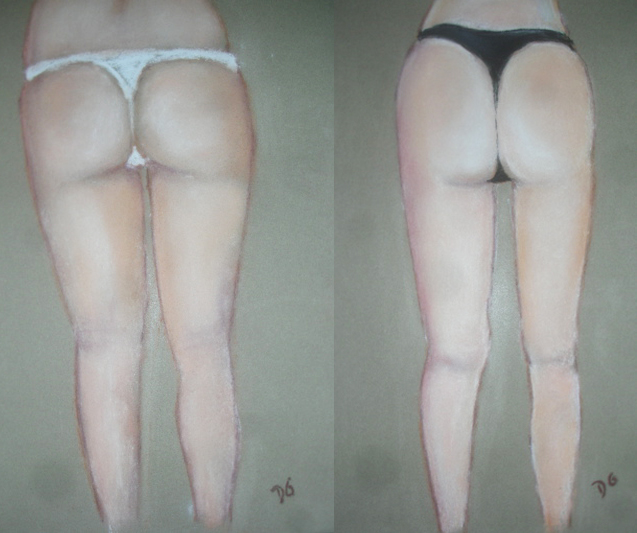 Lifting des cuisses